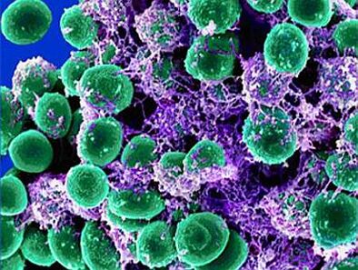 urogenitale pathogenen van prostatitis